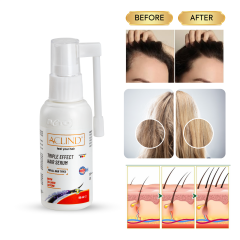 ACLIND® TRIPLE EFFECT SERUM Saç Dökülmesine Karşı Saç Serum