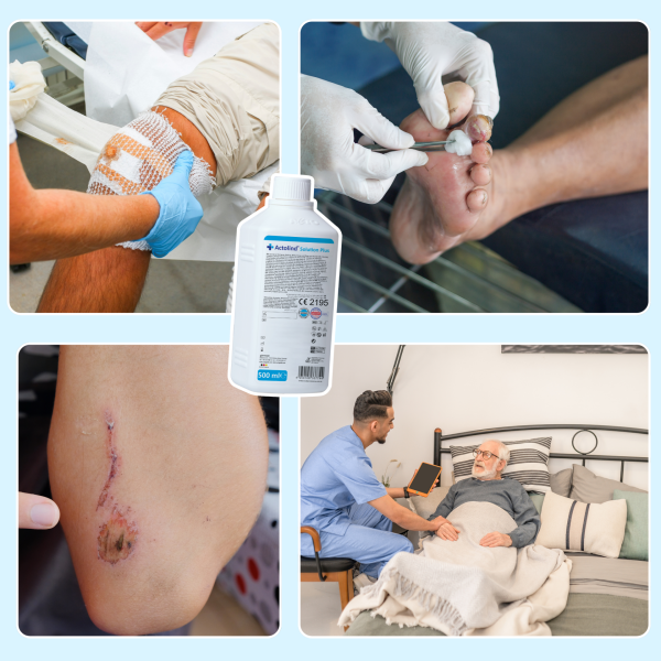 Actolind ® Solution Plus 500 ml | Yara Bakım Solüsyonu