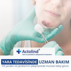 Actolind ® Solution Plus 350 ml | Yara Bakım Solüsyonu