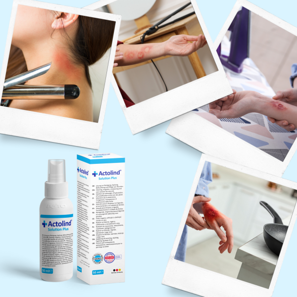 Actolind ® Solution Plus 50 ml | Yara Bakım Solüsyonu