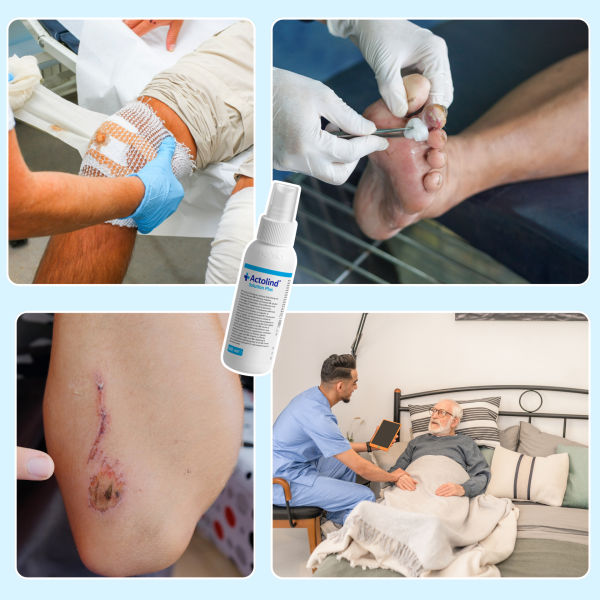 Actolind ® Solution Plus 100 ml | Yara Bakım Solüsyonu