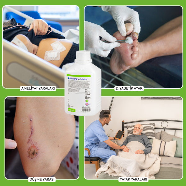Actolind ® w SOLUTION 350 ml | Yara İyileştirme Solüsyonu