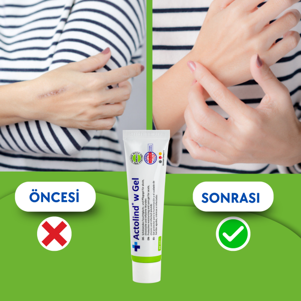 Actolind ® W Gel 30 ml | Yara İyileştirme Jeli