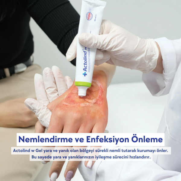 Actolind ® W Gel 10 ml | Yara İyileştirme Jeli