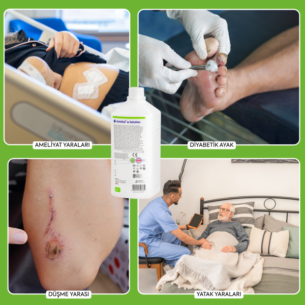 Actolind® w Solution 1 L | Yara İyileştirme Solüsyonu