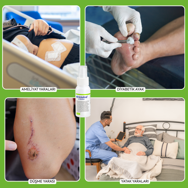 Actolind ® w Solution 50 ml | Yara İyileştirme Solüsyonu