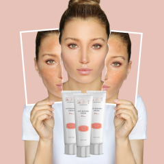 ACLIND® ANTI-BLEMISH CREAM / Leke Karşıtı Krem 30 ml